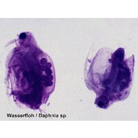 Bresser 100 шт., в кейсе 73765 Image #11